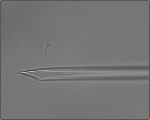 Intra Cytoplasmic Morphologically Selected Sperm Injection (IMSI)